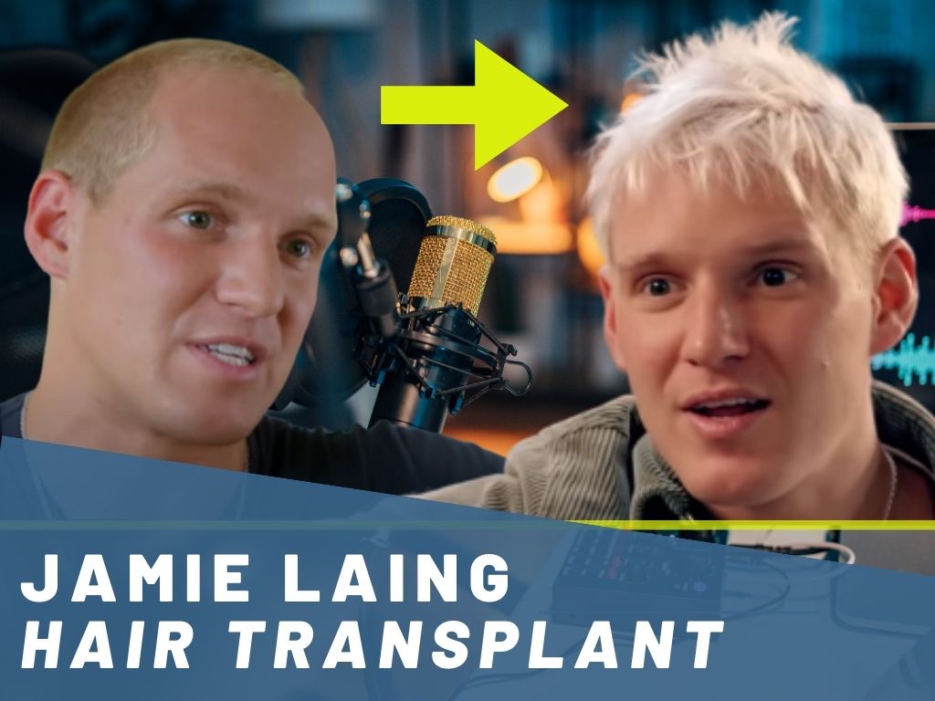 Jamie Laing