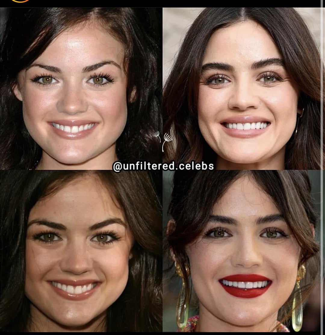 Lucy Hale